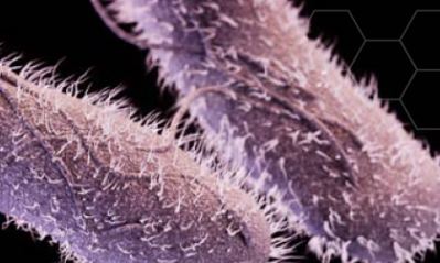 Drug-resistant non-typhoidal Salmonella. Picture: CDC 