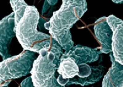 Photo: FSA. Campylobacter was most common foodborne pathogen with about 280,000 cases per year