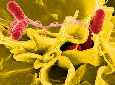Picture: CDC Public Health Image Library. A mustard-colored ruffled immune cell is attacked by red-colored, rod-shaped Salmonella bacteria in this digitally-colorized scanning electron micrograph