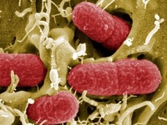 Global partnership unlocks secrets of deadly E.coli 0104 bacteria