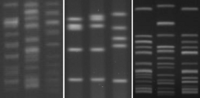 Left: Two gels with fuzzy band. Right: Gel scoring Excellent in the parameter Bands