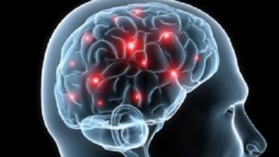 Brain imaging offers 'critical' chance to study effects of diet