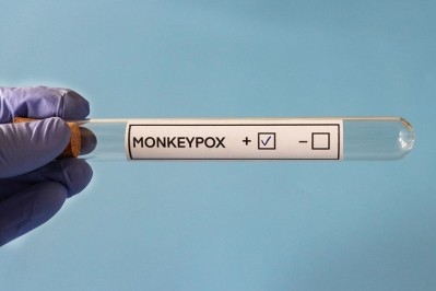 Can the monkeypox virus be transmitted via contaminated food? GettyImages/mtreasure