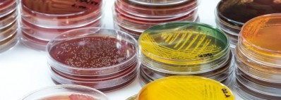 Food microbiology standards: ISO 11133 amendments and ISO 16649 revision