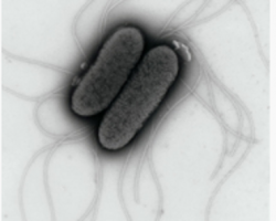 Picture: IFR. Salmonella Typhimurium