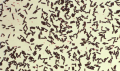 Clostridium perfringens picture: Pathogen Profile dictionery