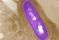 Listeria Picture: CDC